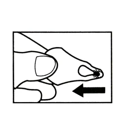 Online Set Of 3 Tick Key Tick Removers Pest Control